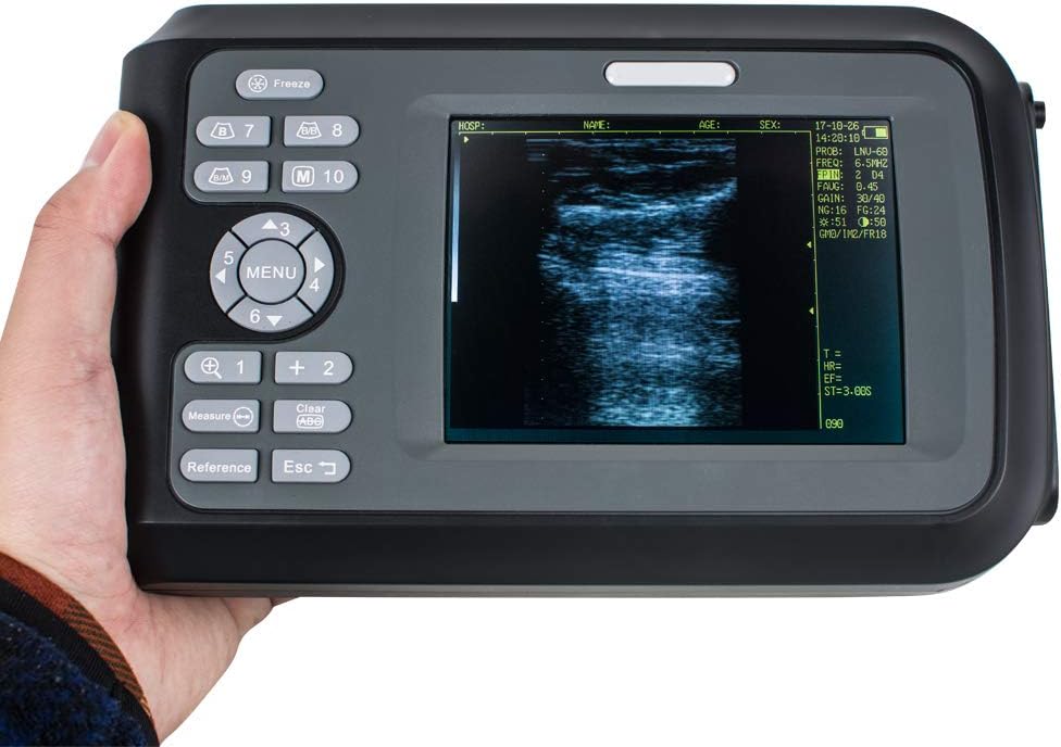 Portable Handheld Veterinary Digital Scanner with 6.5MHz Rectal Handle T7134