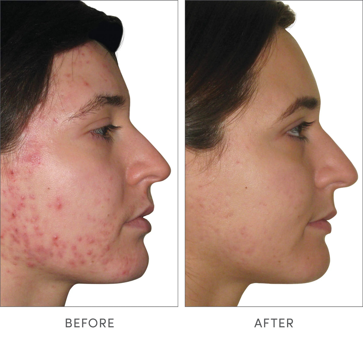 Skin Accumax Supplement O541969
