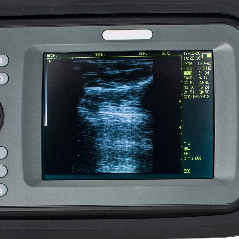 Portable Handheld Veterinary Digital Scanner with 6.5MHz Rectal Handle T7134